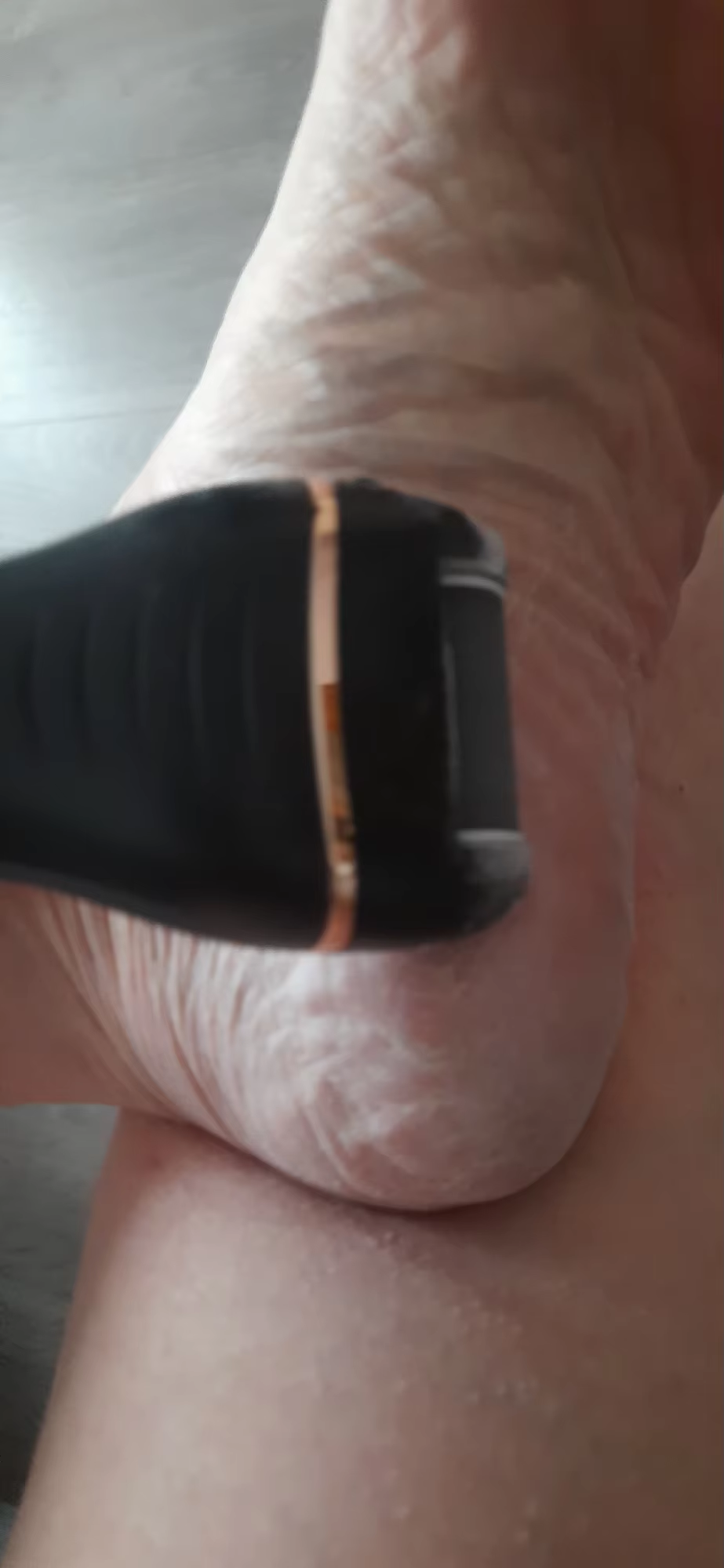 Vevola™ Heel Refiner