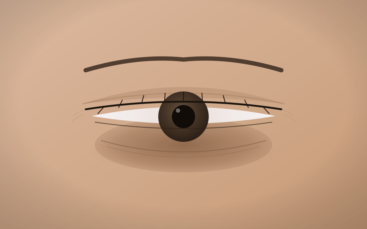 Before using Vevola — tired, puffy eyes with dark circles